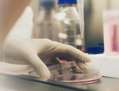 Immune Metabolism & Anti-PD-1/PD-L1 Efficacy in NSCLC